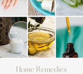 home remedies for chapped hands